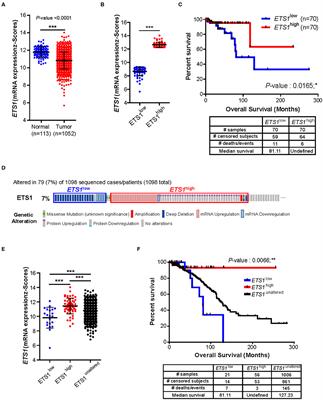 ETS1 Suppresses Tumorigenesis of Human Breast Cancer via Trans-Activation of Canonical Tumor Suppressor Genes